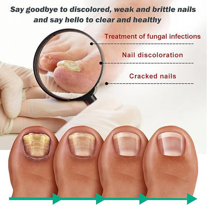 Nexusdrop Nail Fungus Solution