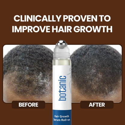 Patented Rosemary Hair Growth Roll-On Serum
