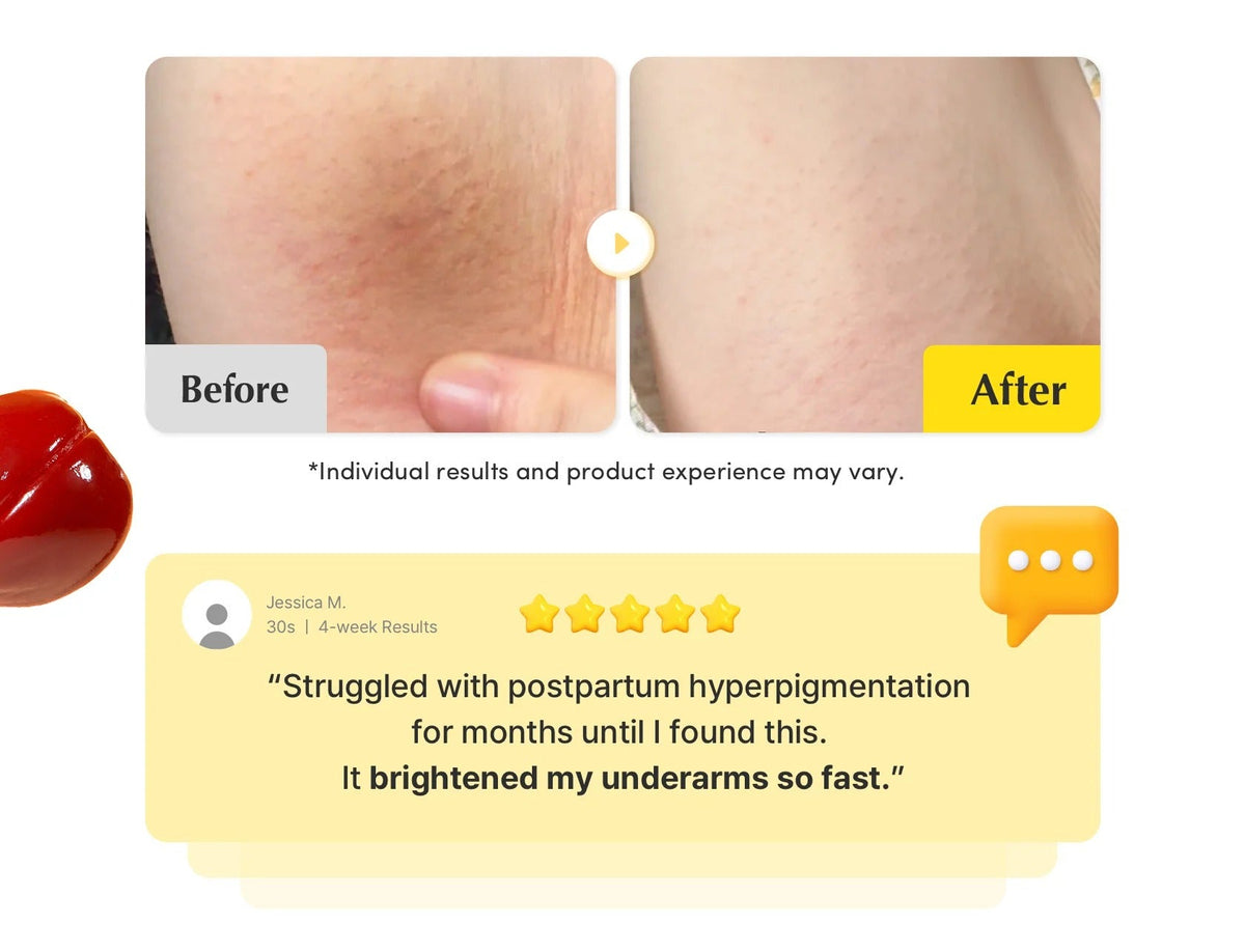 Vitamin Illuminating Dark Spot Serum