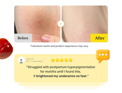 Vitamin Illuminating Dark Spot Serum
