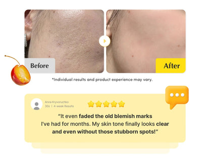 Vitamin Illuminating Dark Spot Serum